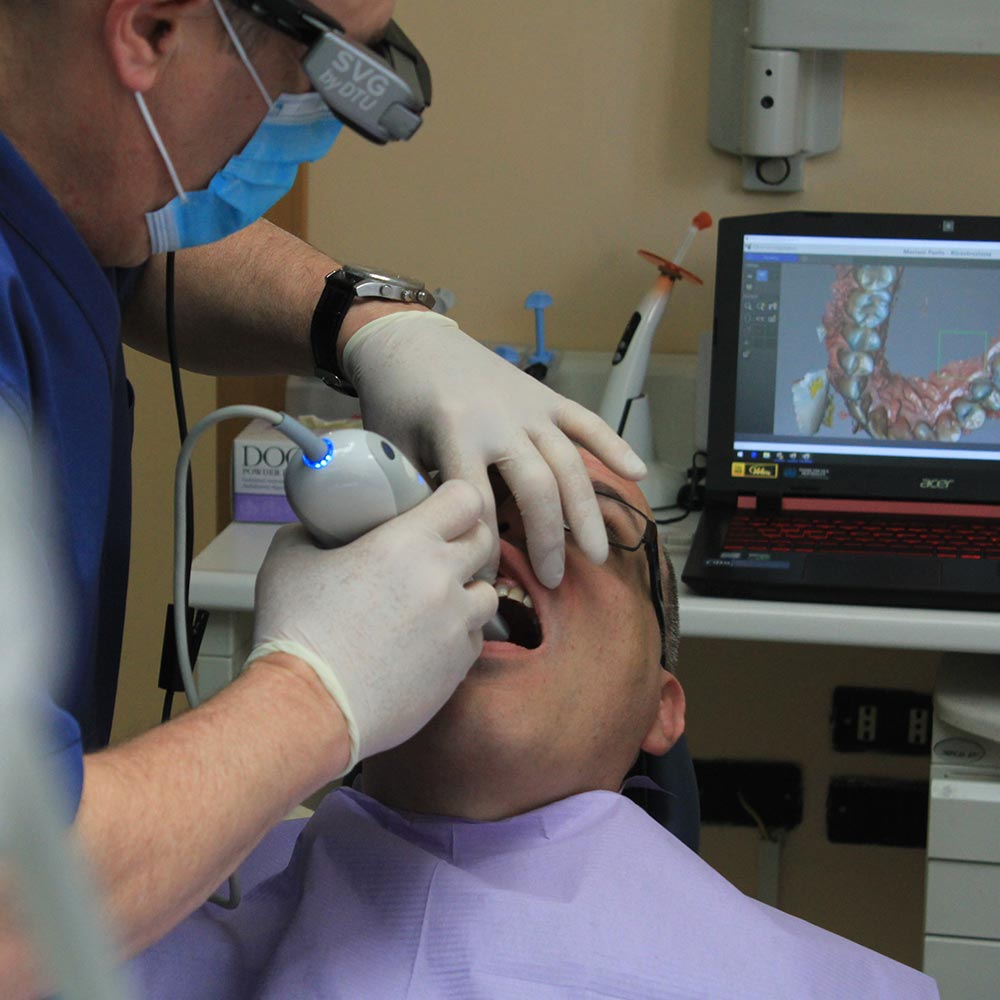 Intero Scan FREE iTero intra-oral Scans for all existing patients at Sarum Dental!