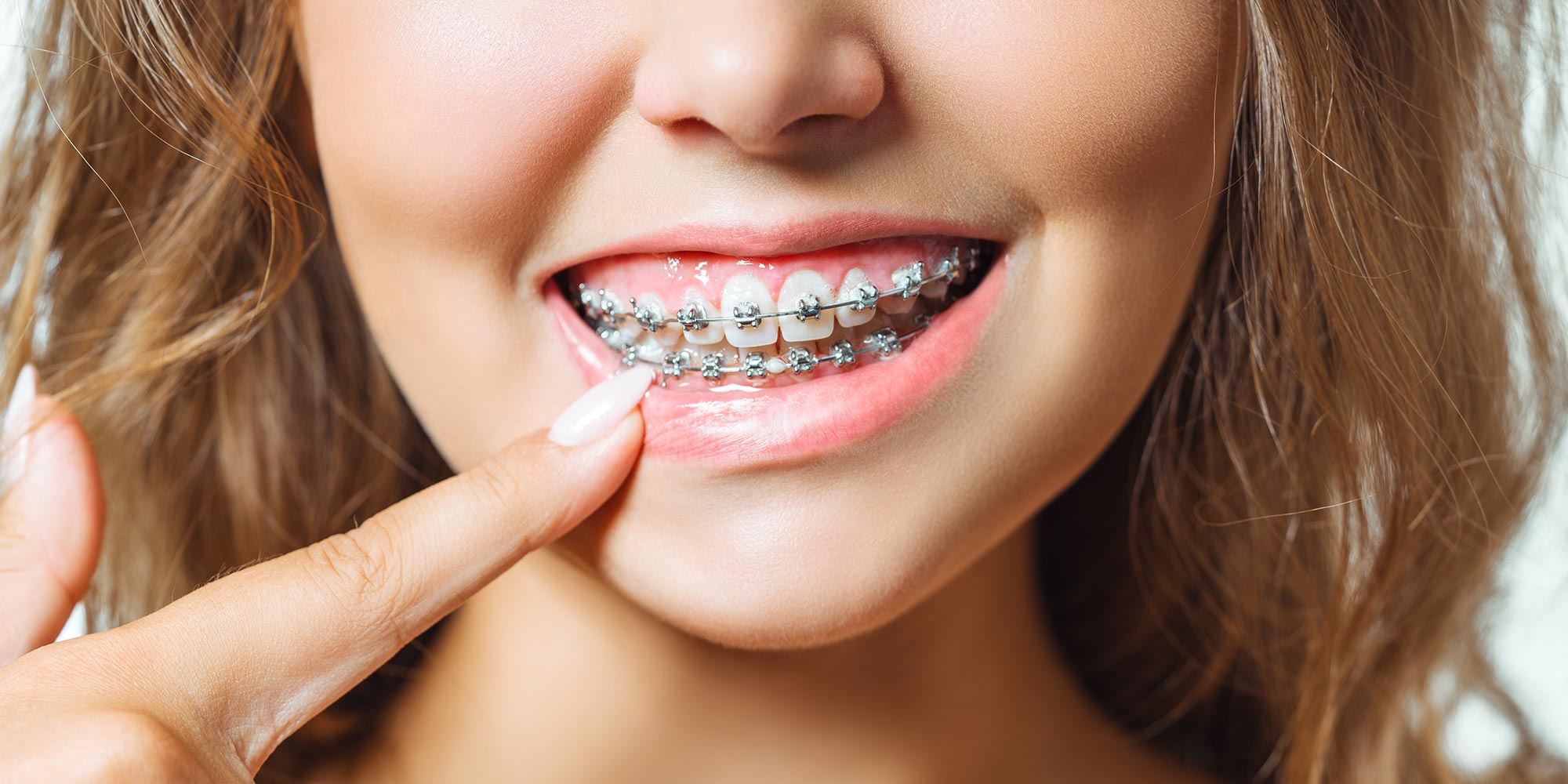 Looking for an Orthodontist in Salisbury?