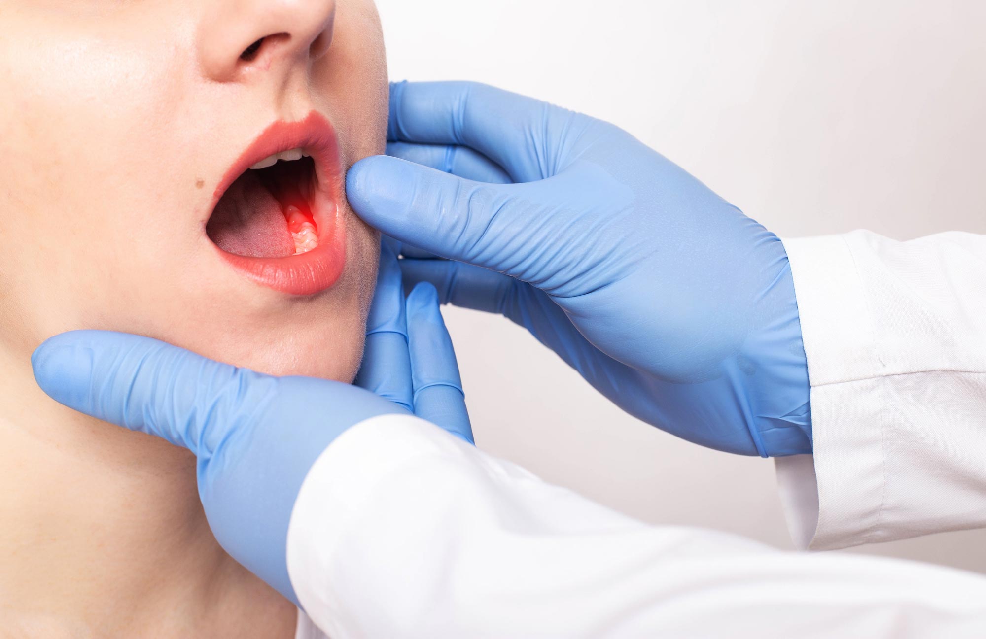 Oral Cancer Screenings – safeguarding your oral health at Sarum Dental